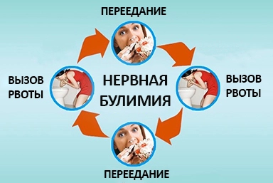 Лечение булимии в Рассказово